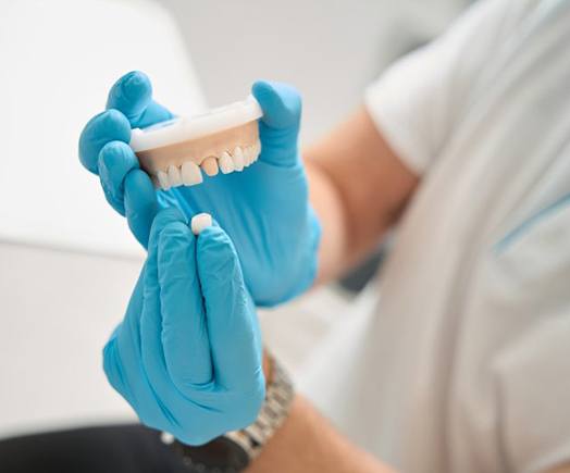 Dentist holding a model set of teeth and a crown